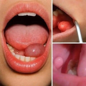 HT17. These are the first symptoms of a…see more