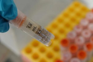 HT17. Scientists Discover a Surprising Link Between Gut Health and OCD