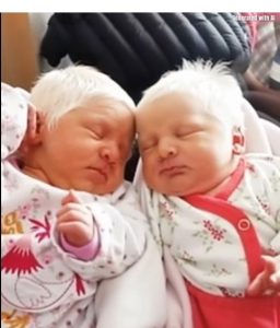 HT17. The First Ever Albino Twins Born In Argentina Will Leave You In Awe