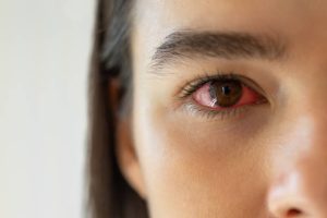 HT16. The Real Consequences of Sleeping With…