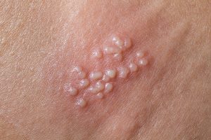 HT16. These are the consequences of sleeping co… See more..