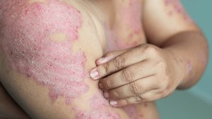 HT17. These are the consequences of sleeping with the…