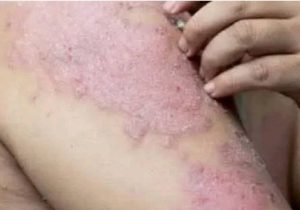 HT16. These are the consequences of sleeping with the…