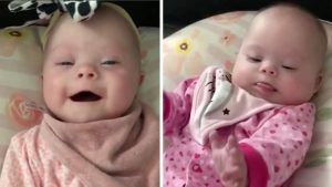 HT16. Mom of rare twins with Down syndrome shuts down critics with photo showing how beautiful they are