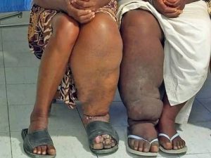 HT17. These are the consequences of sleeping with a… See more