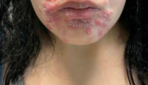 HT13. These are the consequences of sleeping co… See more