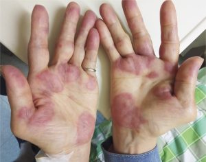 ST17. These are the consequences of sleeping with the…