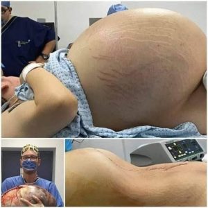 HT17. They told her she was pregnant with triplets, but the… See more