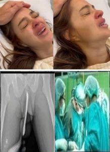 HT17. Girl had to be hospitalized for wanting to use a pe…See more