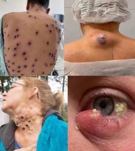 HT17. These are the signs that it’s gro…