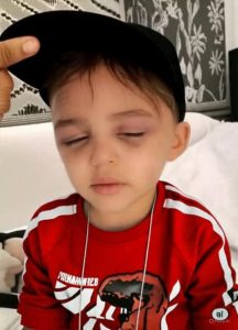 HT17. A 3-year-old boy was found 1 hour ago by his stepfather