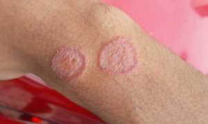 HT17. These are the signs that he is cr…