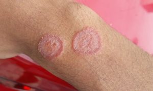 HT15. These are the signs that he is cr…