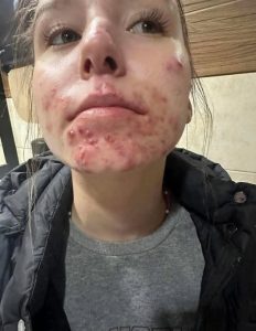 HT17. These are the consequences of sleeping with a… See more here