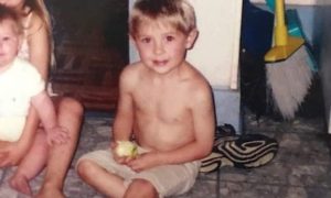 ST16. Burned at Four, Rebuilt by Medicine: The Long Road of a Child Who Refused to Disappear