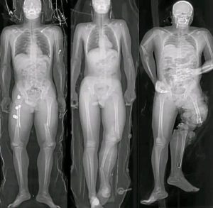 HT15. What you should know if you got the COVID vaccine: The truth behind these viral messages.