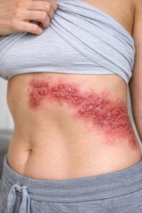 HT17. These are the consequences of sleeping with your c…