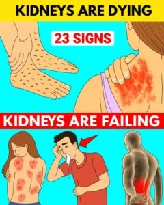 HT17. 23 Strange Signs Your Kidneys Might Be in Trouble