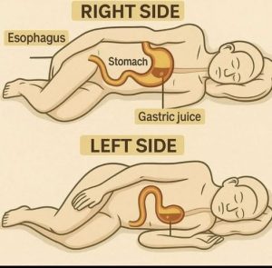 HT17. CAUTION: If you sleep on your RIGHT SIDE, you must have…