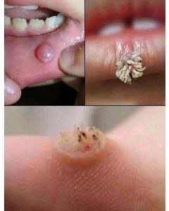 HT17. Be very careful if it comes out in your mouth, you are infected with…See more