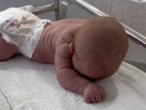 HT15. Baby born with an DIU peg… See more