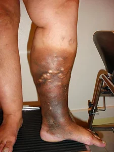 HT13. These are the first symptoms of a… See more