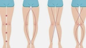 HT17. THE LEGS OF A WOMAN CAN SAY AS IT IS THEIR V*GlN