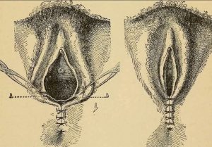 HT17. Enital hygiene our tips … See more
