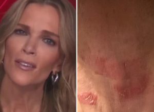 HT15. Megyn Kelly Hospitalized in Critical Condition… See more