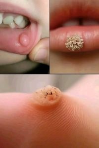 HT17. These are the first signs of an enf…See more