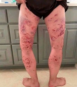 HT17. These are the consequences of sleeping with the… See more