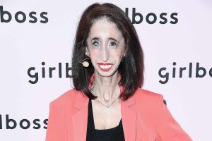 ST17. Turning Cruelty Into Courage and Inspiring Millions