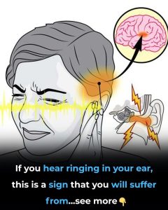 HT17. Ringing in Your Ear? What Tinnitus Really Means and When to See a Doctor