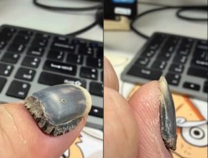 HT17. These are the consequences of using too much n… See more