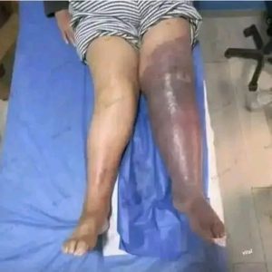 HT17. These are the consequences of sleeping with a… See more