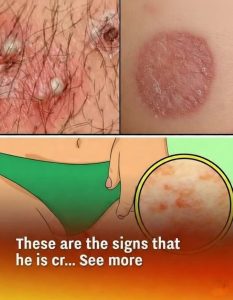 HT13. These are clear signs that he is in trouble…