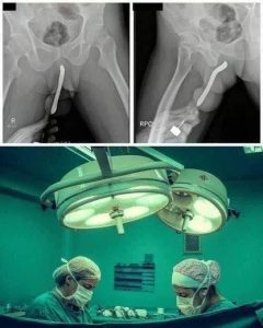 HT17. Girl had to be hospitalized for wanting to use a pe…See more