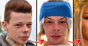 ST16. He paid $73.000 for surgeries to look like a woman…