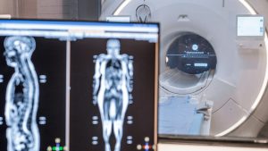 HT17. Doctors reveal the most dangerous objects found in private… See more