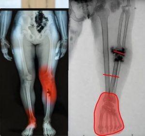 HT19. Those vaccinated against C0-VID alert may be sick…