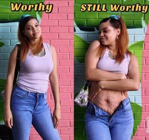 ST19. Woman Shows the Raw Truth of Postpartum Bodies