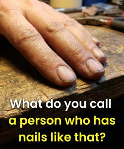 HT17. Before You Judge: What Dirty Nails Might Actually Mean