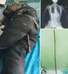 HT13. Young man hospitalized after being arrested…See more