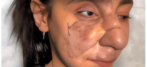 HT13. She Lived in the Shadows for 30 Years — Until a Makeup Artist Helped Her Shine