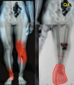 HT13. COVID-19 vaccinated individuals may be ill…See more