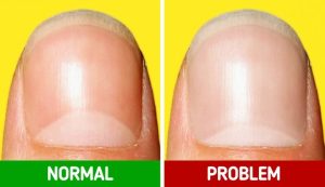 ST13. 10 Signals Your Body Sends to Tell You Something Is Wrong