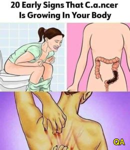 HT13. 20 Early Signs That Can.cer May Be Developing in Your Body