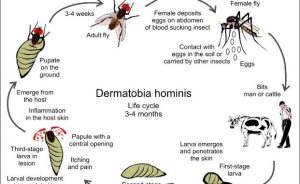 ST19. Myiasis: What Is It, Causes, Signs and Symptoms, and More