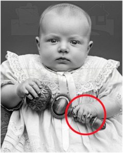 HT13. The 1896 Infant Case That Confounded Doctors — A Victorian Photograph, Advanced Motor Skills, and the Medical Mystery Hidden in the Thornton Archives