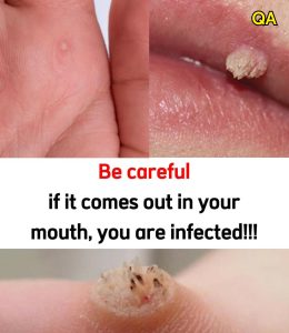 HT13. These are the first signs of an enf…See more…